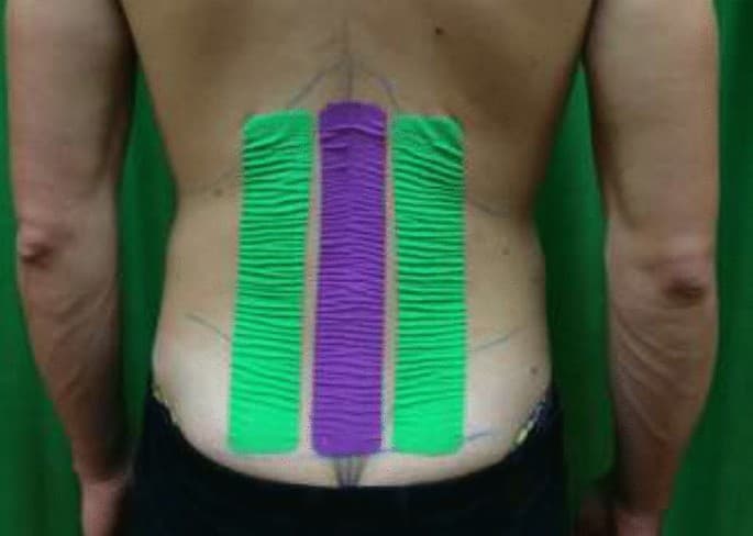 Sports Taping Masterclass